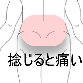 腰痛