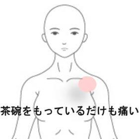 肩の痛み