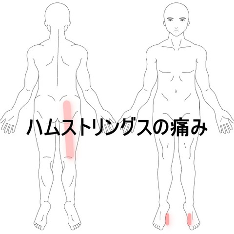 ハム
