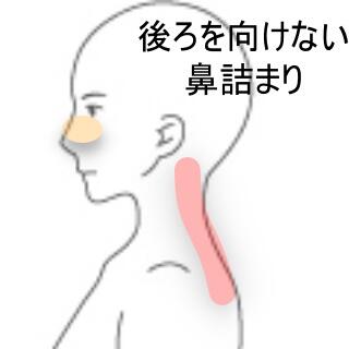 頸痛み