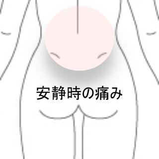 腰痛