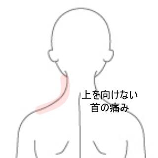 頸の痛み