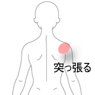 肩の痛み