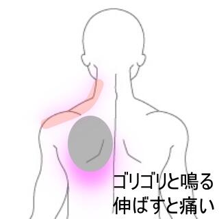 肩こり