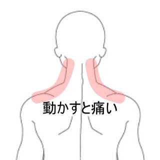 寝違え