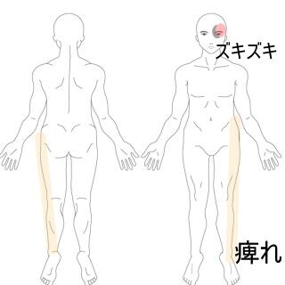痺れと頭痛