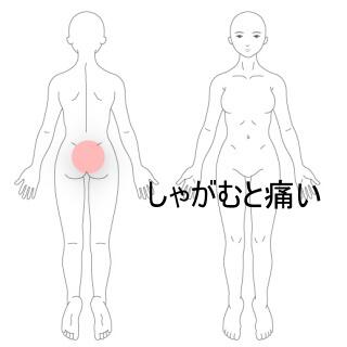 打撲腰痛
