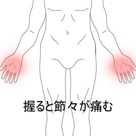 手の痛み
