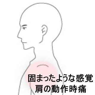 肩の痛み