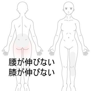 腰痛