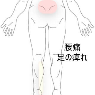 腰痛と足の痺れ