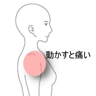肩の痛み