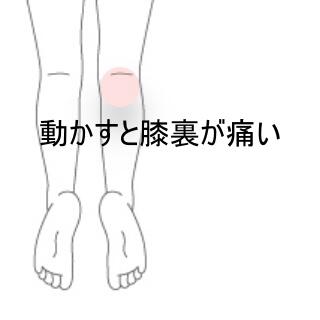 膝裏の痛み