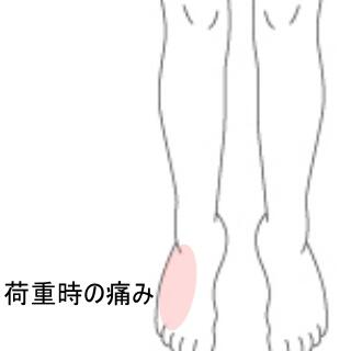 足首の痛み