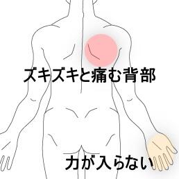 頚背部痛