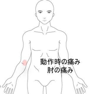 肘の痛み