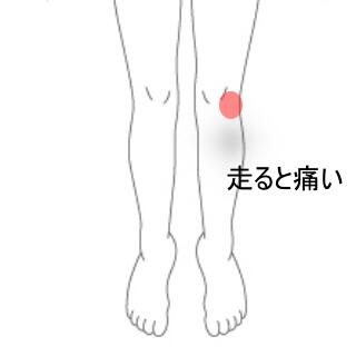 膝痛