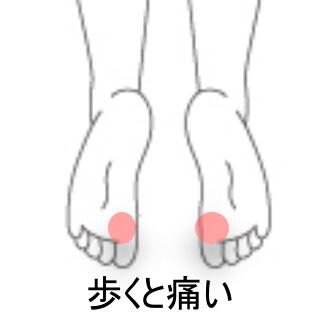 足裏の痛み