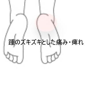 踵の痺れ