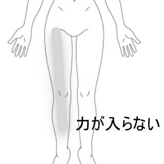 大腿部の痛み