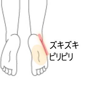 そっこんどうしょうこうぐん