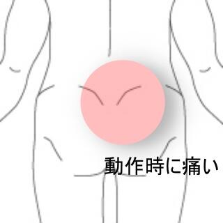 腰痛