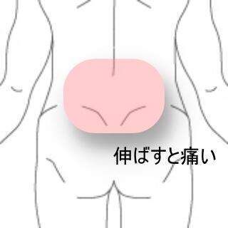 腰痛