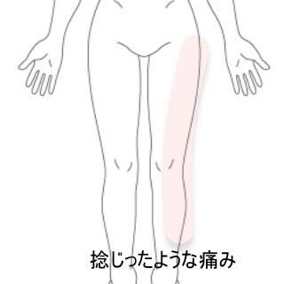 大腿部痛