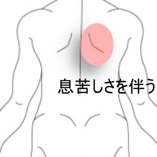 背中の痛み