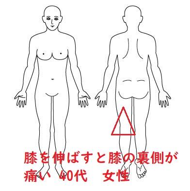 人体図 - コピー - コピー