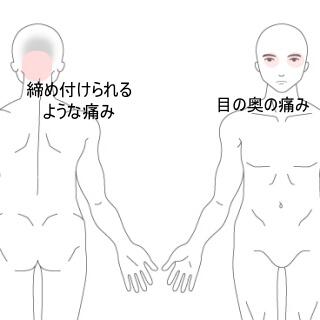 後頭部痛