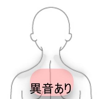 頭痛