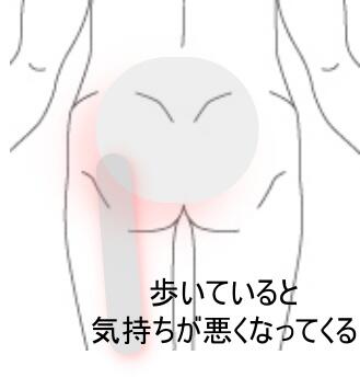 臀部痛