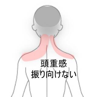 頭重感