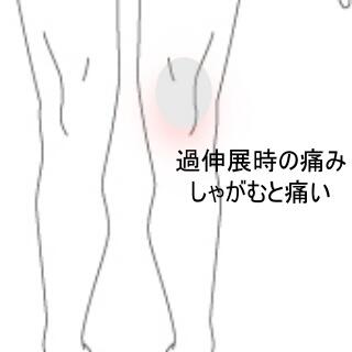 前十字靭帯