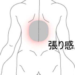背部痛