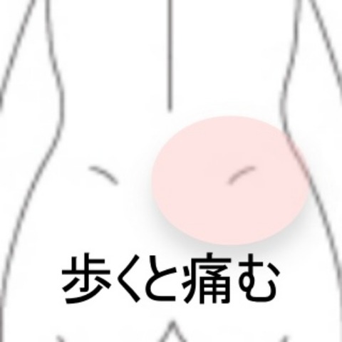 L字ソファーで痛めた