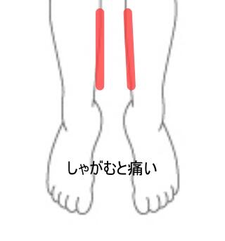 シンスプリント