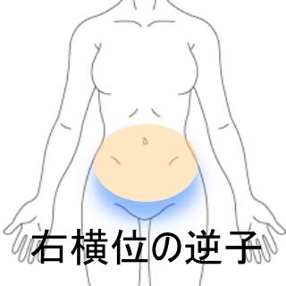 逆子
