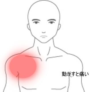 肩の痛み