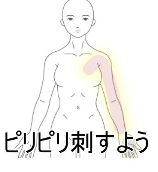 乳房切除後疼痛