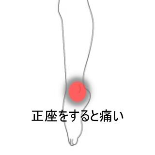 足首捻挫後の痛み