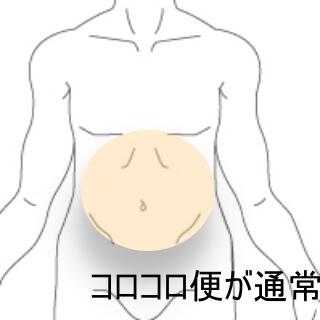 過敏性腸症候群