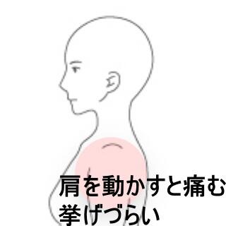 肩の痛み