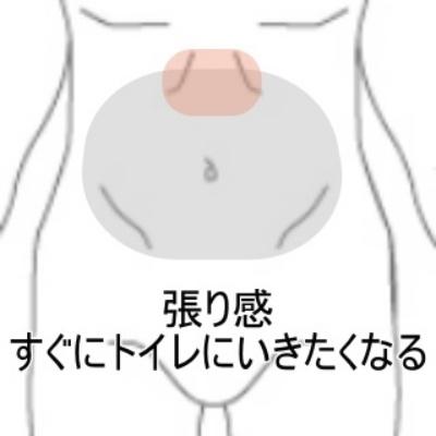 過敏性腸症候群