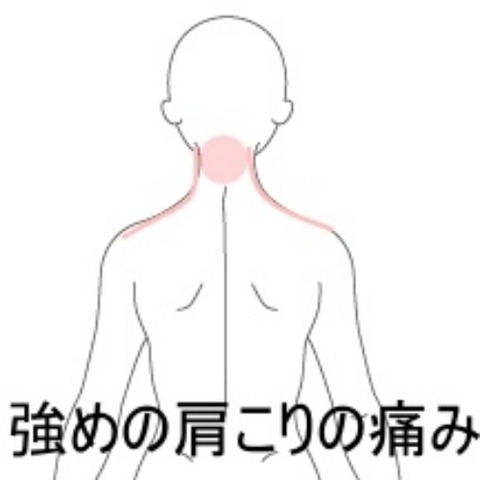 起床時の痛み首
