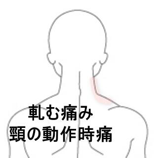 頸の痛み