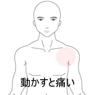 肩の痛み