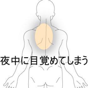背部痛