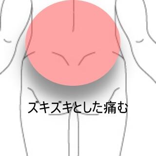 腰痛